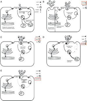 Proteínas que afectan a la función del receptor de lipoproteínas de baja densidad. A) 1. El receptor de lipoproteínas de baja densidad (LDLR) recién sintetizado es transportado a la membrana celular. Tras alcanzar la superficie celular, el receptor de lipoproteínas de baja densidad se une a la apolipoproteína B-100 (apoB-100), la proteína principal de las LDL, formando un complejo. 2. El complejo receptor de lipoproteínas de baja densidad-lipoproteína de baja densidad, localizado en una invaginación recubierta de clatrina, es endocitado mediante interacciones que incluyen a la proteína adaptadora 1 del receptor de lipoproteínas de baja densidad (LDLRAP1). 3. Dentro del endosoma, el complejo se disocia: apoB-100 y lípidos se dirigen a los lisosomas, donde se degradan; el receptor de lipoproteínas de baja densidad se recicla a la membrana celular. 4. La proproteína convertasa subtilisina/kexina de tipo 9 (PCSK9) actúa como inhibidor postranscripcional del receptor de lipoproteínas de baja densidad y, a través de una interacción con él, dirige al receptor de lipoproteínas de baja densidad hacia la degradación en lugar de hacia el reciclaje. B) En presencia de mutaciones de pérdida de función en el gen que codifica el receptor de lipoproteínas de baja densidad, este receptor no se sintetiza, no se transporta ni se presenta en la superficie, por lo que su función está alterada. C) En presencia de mutaciones en la región de unión de la apoB al receptor de lipoproteínas de baja densidad, disminuye su capacidad para unirse al receptor de lipoproteínas de baja densidad, con la consecuente reducción de la captación de partículas de lipoproteínas de baja densidad. D) En presencia de mutaciones de aumento de función en el gen que codifica la PCSK9, la mayoría de los receptores de lipoproteínas de baja densidad se dirige a la degradación, con la consiguiente reducción del número de receptores de lipoproteínas de baja densidad que se reciclan a la superficie celular. E) En presencia de mutaciones de pérdida de función en el gen que codifica la LDLRAP1, que facilita la interacción entre el receptor de lipoproteínas de baja densidad y la maquinaria celular que regula el proceso de endocitosis, se altera la internalización del complejo receptor de lipoproteínas de baja densidad-proteínas de baja densidad.