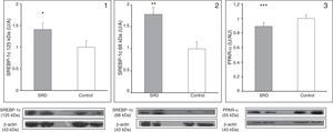 Hepatic expression of precursor (1) and mature (2) SREBP-1c and PPAR-α (3) in SRD and control rats. Immunoblot quantification by densitometry. Results are represented as mean±SE and are expressed as arbitrary units in relation to the control group. Bottom: representative immunoblot bands of SREBP-1c (precursor and mature forms), PPAR-α, and its corresponding β-actin band. *p=0.045; **p=0.032 and ***p=0.014.