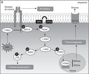 A. Señalización hepática de la insulina. La insulina, a su llegada al hepatocito, se une y activa el receptor tirosina cinasa de la insulina (RTKI), el cual promueve la fosforilación del sustrato del receptor de la insulina (SRI), siendo el SRI2 el más importante a nivel hepático. La fosforilación de SRI2 genera sitios de unión para la quinasa fosfatidilinositol 3 —PI(3)K—. La unión de PI(3)K a SRI2 convierte el lípido de membrana fosfatidilinositol 4,5-bifosfato (PIP2) en fosfatidilinositol 3,4,5-trifosfato (PIP3) que, a su vez, recluta Akt2. Bajo condiciones de estímulo de insulina, la proteína cinasa D (PDK1) es fosforilada y activa Akt2, que parece suprimir la producción hepática de glucosa mediante 2 mecanismos principales: primero, la disminución de la expresión de las enzimas gluconeogénicas mediante la fosforilación y la exclusión nuclear de la proteína FOXO1, que inhibe la activación de la expresión de proteínas gluconeogénicas como la glucosa-6 fosfatasa (G6Pasa) y la fosfoenolpiruvato carboxiquinasa (PEPCK), dando lugar a la supresión de la gluconeogénesis hepática; y en segundo lugar, el aumento de la actividad de la glucógeno sintasa (GS) mediante la fosforilación e inactivación de la quinasa glucógeno sintasa 3 (GSK3). En su forma inactiva (fosforilada), GSK3 no cataliza la fosforilación e inactivación de la GS, permitiendo así la síntesis de glucógeno hepática.B. Mecanismos moleculares de DAG-PKC¿ que median la resistencia a la insulina hepática. La acumulación hepática de DAG permite la activación y translocación de PKC¿ hacia la membrana plasmática, lo que provoca la inhibición del receptor quinasa de la insulina y su señalización intracelular.