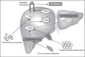 Mecanismos implicados en la acumulación hepática de DAG. El aumento en el contenido hepático de DAG es el resultado de un desequilibrio entre la captación/liberación de ácidos grasos (AG), la tasa de oxidación mitocondrial de AG y la conversión de los DAG a triglicéridos (TG) durante la lipogénesis hepática. Que la ratio de la ingesta energética sea superior al gasto energético es una de las causas de la EHGNA y resistencia a la insulina (RI) hepática inducida por el mecanismo DAG-PKC¿. La predisposición de factores genéticos, como las variantes genéticas de APOC3 que provocan un aumento de las concentraciones plasmáticas APOC3, dan lugar a la supresión de la actividad de la lipoproteína lipasa, el aumento de quilomicrones remanentes posprandiales, y el aumento de la captación hepática de AG, contribuyendo al incremento del contenido hepático de DAG. Defectos en el almacenamiento lipídico en los adipocitos, tales como las lipodistrofias, así como alteraciones genéticas o adquiridas en la oxidación mitocondrial de AG, pueden contribuir a la acumulación hepática de DAG y consecuente desarrollo de EHGNA y RI hepática. Finalmente, los ácidos grasos liberados durante la lipólisis en los adipocitos entrarían en el hígado mediante transportadores específicos de AG (FATP2/5), aumentando el contenido hepático de DAG.