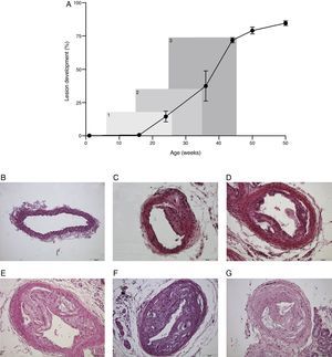The progression of atherosclerosis in carotid arteries from Apo E-deficient mice is exponential rather than linear (A). In a typical treatment period of 20 weeks the assessment in the amount of lesion changes considerably (6–26 weeks, 19%; 15–35 weeks, 36%; 25–45 weeks, 73%). This may have implications in the aim and design of the experiments. Representative microphotographs of lesions are depicted for mice with 16 (B), 24 (C), 36 (D), 44 (E), 50 (F) and 60 (G) weeks of age. All sections were stained with haematoxylin and eosin and the scale bar of 100μm represents a magnification of 100×.