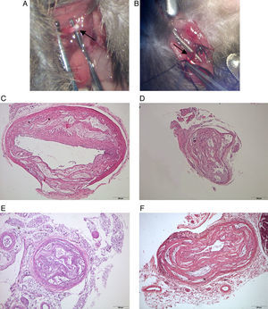 Manipulation of small arteries requires the use of microscopy but may be used to design experimental models related to the management of peripheral artery disease, including stroke (A, B). The blood flow of most arteries is compromised but mice remain viable over the 60 weeks of age. This is illustrated in aorta (C), carotid (D), femoral (E) and iliac (F) arteries. All sections were stained with haematoxylin and eosin and the scale bar of 200μm represents a magnification of 40×.
