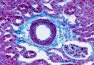 Tinción de fibras de colágeno por técnica de Masson. Imagen representativa: vaso procedente de corteza renal del ratón deficiente en apolipoproteína E como modelo de aterosclerosis. El depósito de matriz extracelular fibrilar en el tejido conjuntivo se aprecia en color azul. Se observa fibrosis con depósito incrementado de matriz extracelular. Magnificación 400×.