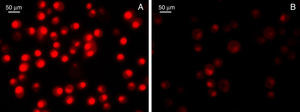 Detección de la producción del anión superóxido. Se utilizó el colorante fluorescente dihidroetidio (DHE; Invitrogen, Grand Island, NY, EE.UU.), y un score de la intensidad del color rojo permitió evaluar la producción del anión superóxido en cultivo de células Bv-2 gliales de ratón sometidas a lesión por lipopolisacáridos en ausencia (A) o presencia (B) de alicina.