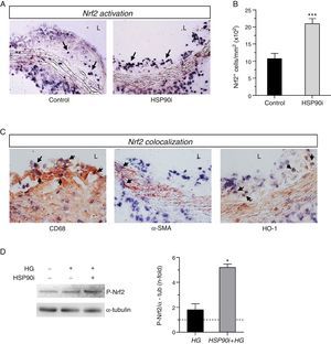 HSP90 inhibition activates Nrf2 in atherosclerotic lesions and in vitro. (A) Representative images of in situ detection of activated Nrf2 in aortic sections of diabetic apoE−/− mice after 10 weeks of treatment with either vehicle (control) or HSP90 inhibitor (HSP90i). (B) Quantification of positive cells per lesion area. Mean±SEM of 8 animals per group. ***p<0.01 vs. control. (C) Colocalization of Nrf2 (blue-purple) with CD68, α-SMA, and HO-1 (red-brown immunoperoxidase). Magnifications ×200 (A) and ×400 (C); arrows indicate positive staining; L, lumen. (D) Western blot analysis of phosphorylated Nrf2 in bone marrow-derived macrophages pretreated with HSP90 inhibitor (50nmol/L, 4h) prior to stimulation with high glucose (HG, d-glucose 30mmol/L, 6h). Results expressed as relative increases over basal (horizontal dashed line) are mean±SEM of 3 independent experiments. *p<0.05 vs. basal.