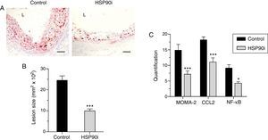 Anti-atherosclerotic effect of HSP90 inhibition in diabetic mice: lesion size and inflammatory markers. (A) Representative images (magnification ×200; L, lumen) of Oil Red O/hematoxylin staining in aortic root sections of diabetic apoE−/− mice treated with vehicle (control) and HSP90 inhibitor (HSP90i). (B) Quantification of lesion area. (C) Quantitative evaluation of inflammatory markers in atherosclerotic lesions. Results expressed as % of positive staining (MOMA-2 and CCL2; immunoperoxidase) or number of positive cells per lesion area (NF-κB; Southwestern histochemistry) are mean±SEM of 8 animals per group. *p<0.05, ***p<0.01 vs. control.