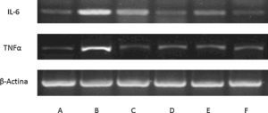 Expresión de mediadores inflamatorios en cultivo de macrófagos gliales de ratón. Blot representativo con expresión en macrófagos controles (A), lesionados con lipopolisacáridos (B-F) e incubados con: alicina (C), fenil-isotiocianato (D), erucina (E) e indol-3-carbinol (F). Claramente se muestra la respuesta pro-inflamatoria de lipopolisacáridos y como el tratamiento con fitoquímicos puede modularla (n=3).