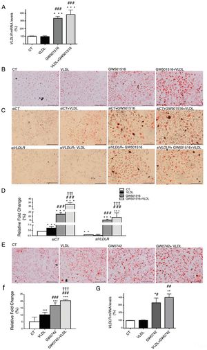 Intracellular accumulation of triglycerides in hepatocytes caused by GW501516 is inhibited by VLDLR knockdown. (A) mRNA abundance of VLDLR. (B) Oil Red O staining in Huh-7 hepatocytes incubated for 24h in the absence (Control, CT) or presence of VLDL (300μg/mL) and/or GW501516 (10μM). (C) Oil Red O staining in Huh-7 hepatocytes non-transfected or transfected with siRNA control or siRNA against VLDLR and incubated for 24h in the absence (Control, CT) or presence of VLDL (300μg/mL) and/or GW501516 (10μM). Scale bar: 100μm. (D) Quantification of ORO staining of Fig. 2B. Data are presented as the mean±S.D. (n=4 per group). (E) Oil Red O staining in Huh-7 hepatocytes incubated for 24h in the absence (Control, CT) or presence of VLDL (300μg/mL) and/or GW0742 (10μM). (F) Quantification of ORO staining of Fig. 2D. Data are presented as the mean±S.D. (n=4 per group). (G) mRNA abundance of VLDLR. ***p<0.001, **p<0.01 and *p<0.05 vs. CT group. ###p<0.001, ##p<0.01 and #p<0.05 vs. VLDL-exposed cells. †††p<0.001 vs. GW501516-exposed cells.