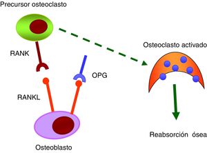 Sistema RANK/RANKL/OPG. OPG: osteoprotegerina; RANK: receptor activador del factor nuclear κB; RANKL: ligando del receptor activador del factor nuclear κB.