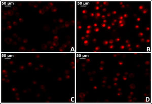 Determinación del estrés oxidativo celular en tejido miocárdico de rata mediante la técnica del colorante fluorescente dihidroetidio para evaluar la producción de anión superóxido. A) Tejido miocárdico proveniente de ratas normotensas (WKY). B) Tejido miocárdico proveniente de ratas espontáneamente hipertensas (SHR). C) Tejido miocárdico proveniente de ratas normotensas tratadas con losartán a razón de 40mg/kg/día en el agua de bebida (WKY+Los). D) Tejido miocárdico proveniente de ratas espontáneamente hipertensas tratadas con losartán a razón de 40mg/kg/día en el agua de bebida.
