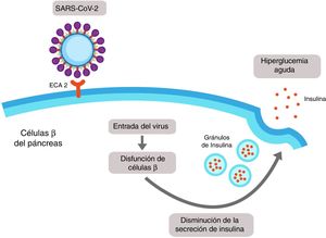 Daño pancreático inducido por SARS-CoV-2. Las células de los islotes del páncreas expresan enzima conversora de angiotensina 2 (ECA2) en su membrana. El SARS-CoV-2 se une al dominio extracelular de la ECA2 y entra en la célula β del páncreas, donde induce disfunción celular que pudiera conllevar a disminución en la secreción de insulina y finalmente a hiperglucemia.