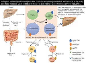 Patogenia de la dislipemia aterogénica en contexto de HTG, resistencia a la insulina y esteatosis hepática. La obesidad abdominal y la diabetes tipo 2 son fenotipos clínicos frecuentes. ApoAI: apolipoproteína AI; ApoB: apolipoproteína B; CE: éster de colesterol; CETP: proteína de transferencia de ésteres de colesterol; AGL: ácidos grasos libres; HDL: lipoproteínas de alta densidad; HTGL: lipasa hepática; LDL: lipoproteínas de baja densidad; LPL: lipoproteína lipasa; VLDL: lipoproteínas de muy baja densidad. Adaptado de: Watts et al.3.