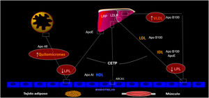 Metabolismo de lipoproteínas ricas en triglicéridos (LRTGL). Cuando hay un déficit parcial o total del funcionalismo de la lipoproteinlipasa (LPL) se compromete el catabolismo de las LRTGL de manera que pueden haber quilomicronemia tras ayuno con/sin aumento de VLDL, dependiendo de la causa subyacente. Todo ello se traduce en hipertrigliceridemia grave (> 1.000 mg/dL) dado el alto contenido en triglicéridos de tales partículas. VLDL: lipoproteínas de muy baja densidad.