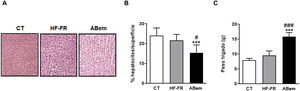 Hipertrofia hepática y peso del hígado. (A) Imagen representativa de la tinción por hematoxilina y eosina de cortes de hígado para los tres grupos de estudio. (B) Porcentaje (%) de núcleos de hepatocitos por superficie cuantificada para la valoración de la hipertrofia hepática. (C) Peso del hígado a final de tratamiento expresado en g. Los resultados son la media±DE para n=8 animales/grupo. ABem: grupo alimentado con HF-FR y tratado con ácido bempedoico; CT: grupo control; HF-FR: grupo alimentado con dieta rica en grasa suplementada con fructosa en el agua de bebida. ***p<0,001 vs. grupo CT. #p<0,05, ###p<0,001 vs. grupo HF-FR.