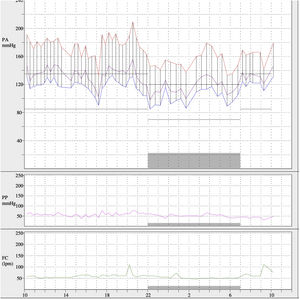 Monitorización ambulatoria de presión arterial antes de realizar angioplastia. Se detectaron unos valores promedio de 24h de 168/113mmHg, media diurna de 174/119mmHg y media nocturna de 152/101mmHg.