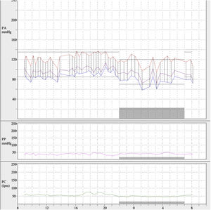 Monitorización ambulatoria de presión arterial después de realizar angioplastia. Los valores de presión arterial promedio de 24h fueron 121/84mmHg, media diurna de 123/87mmHg y media nocturna de 117/74mmHg.