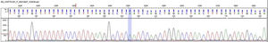 Déficit de lipoproteína lipasa, electroferograma: estudio molecular por secuenciación de nueva generación de los genes LPL, APOA5, APOC2, GPIHBP1 y LMF-1. El análisis identificó una mutación homocigota en el gen LPL (lipoproteína lipasa, OMIM* 609708): c.547G>A (pAsp183Asn) [dbSNPrs118204064]. Fuente: Mendelics Analise Genomica S, Sao Paulo, Brasil.