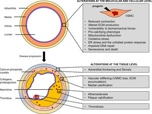 Vascular smooth muscle cell (VSMC) defects underlie premature vascular disease in Hutchinson-Gilford progeria syndrome. Progerin expression in VSMCs triggers a series of molecular and cellular defects (impaired contraction, altered extracellular matrix production/remodeling, vulnerability to biomechanical forces, osteo/chondrogenic phenotype, defective DNA repair, oxidative stress, mitochondrial dysfunction, endoplasmic reticulum stress and the unfolded protein response) that lead to VSMC senescence and death. Changes in VSMC function and their loss in the arteries result in vascular stiffness, calcification, adventitial thickening, atherosclerosis and its life-threatening complications, such as thrombosis. ECM, extracellular matrix; ER, endoplasmic reticulum.