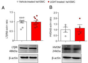 Analysis of the LTβR and HVEM protein content in haVSMC. Protein quantification in the western blot analysis displayed as (A) LTβR/β-actin and (B) HVEM/β-actin ratios in haVSMC treated with vehicle or LIGHT 20ng/μl overnight. Representative blots are shown for the western blot analysis. Statistical analysis were performed by the Student