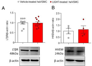 Analysis of the LTβR and HVEM protein content in haVSMC. Protein quantification in the western blot analysis displayed as (A) LTβR/β-actin and (B) HVEM/β-actin ratios in haVSMC treated with vehicle or LIGHT 20ng/μl overnight. Representative blots are shown for the western blot analysis. Statistical analysis were performed by the Student's t-test.
