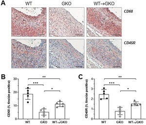 La transferencia adoptiva de macrófagos con FcγR activadores aumenta el infiltrado inflamatorio en las lesiones AAA. Imágenes representativas (barras de escala, 50μm) de la tinción inmunohistoquímica (A) y cuantificación del área de tinción positiva de macrófagos CD68+ (B) y linfocitos B CD45B+ (C) en lesiones AAA de ratones de los grupos WT, GKO y WT→GKO. Valores individuales y media±DE de 5 ratones por grupo.