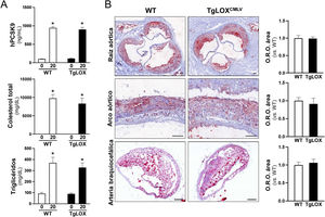 Impacto de la transducción con PCSK9D374Y combinada con dieta aterosclerótica sobre los niveles plasmáticos de PCSK9 y de lípidos circulantes y el desarrollo de lesiones ateroscleróticas en ratón. Los ratones TgLOXCMLV (barras negras) y control (WT; barras blancas) recibieron una inyección única de AAV-PCSK9D374Y y se alimentaron con dieta aterogénica durante 20 semanas. A)Niveles plasmáticos de la proteína PCSK9 humana (hPCSK9) y de colesterol total y triglicéridos al inicio (0 semanas) y al final (20 semanas) del procedimiento experimental. Los resultados se expresan como media±SEM (n=15). *p<0.0001 vs. t=0. B)Imágenes representativas de la tinción Oil Red O (ORO) y su cuantificación en secciones de raíces aórticas (panel superior, n=15), arco aórtico (panel central, n=7) y arteria braquiocefálica (panel inferior, n=7-9) de cada grupo experimental tras las 20 semanas de estudio. Los resultados se expresan como media±SEM.