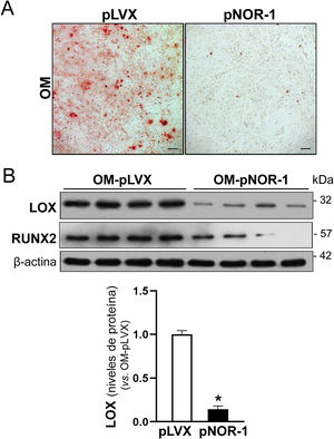 Efecto de la sobreexpresión de NOR-1 en células valvulares intersticiales (VIC) sobre la calcificación y la expresión de la LOX. Las células valvulares intersticiales (VIC) se transdujeron con un vector lentiviral para sobreexpresar NOR-1 (pLVX/NOR-1, pNOR-1) o con el vector lentiviral vacío (pLVX) y se incubaron en medio osteogénico (OM). A)Imágenes representativas de la tinción de rojo de alizarina en VIC transducidas con pNOR-1 o pLVX y expuestas a OM. Barras: 100μm. B)Imágenes representativas del análisis por Western Blot de los niveles de proteína de LOX y RUNX2 en estas células. El gráfico de barras muestra la cuantificación densitométrica de los niveles de LOX en células transducidas con pLVX (barras blancas) y pNOR-1 (barras negras). Los resultados se expresan como media±SEM (n=4). * p<0,05 vs. VIC transducidas con pLVX expuestas a OM.