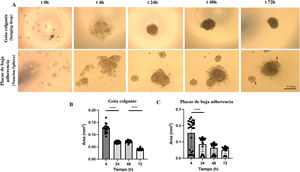 Dinámica de formación de esferoides 3D de HUVEC-HUASMC en condiciones de gota colgante o en placa de baja adherencia (Nunclon Sphera). A) Imágenes representativas de campo claro de la formación de esferoides en una cinética de tiempo definida (t0 siembra, 4 horas, 24 horas, 48 horas, 72 horas). Las imágenes superiores representan la formación del esferoide en gota colgante. Las imágenes inferiores representan la formación del esferoide en placas de baja adherencia Nunclon™ SpheraTM B). Cuantificación del área del esferoide en el tiempo medido en mm2 en n=24 esferoides en gota colgante, n=22 en placa de baja adherencia. ****p<0,0001. 1,2 indicativo de varios tamaños de esferas. Barras de error 0,25mm. One way-ANOVA, Turkey multiple comparison. Media±SEM. ****p<0,0001.
