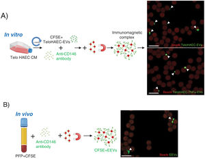 Endothelial extracellular vesicles (EEVs) immunocapture in vitro and in vivo. (A) TeloHAEC-EVs were obtained by centrifugation (20,000×g, 70min) of control or TNFα stimulated TeloHAECs conditioned medium (CM). After CFSE staining, CFSE positive TeloHAEC-EVs or TeloHAEC-TNFα-EVs (in green) were incubated overnight with the anti-CD146 antibody, followed by conjugation with immunomagnetic beads (in red). The EVs-anti-CD146-beads complexes were pool down with a magnet and taken for confocal microscopy. On the upper right-hand panel, a representative image of immunomagnetic beads (reddish background) alone or and bound to aggregates of TeloHAEC-EVs (green). On the lower right-hand panel, the immune-binding of TeloHAEC-TNFα-EVs. (B) Immunomagnetic separation of EEVs from platelet-free plasma (PFP) stained with CFSE. PFP was incubated overnight with the anti-CD146 antibody and then conjugated to immunomagnetic beads. The CFSE+EVs-anti-CD146-beads complexes were pool down with a magnet and visualized by confocal microscopy. Scale bar denotes 10μm.