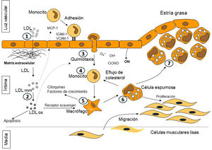 Etapas en la formación de la placa de ateroma. 1-2: entrada de las lipoproteínas de baja densidad (LDL) en el espacio subendotelial y posterior modificación; 3-5: liberación de factores de crecimiento y citoquinas que promueven la diapédesis de los monocitos hacia la íntima y su diferenciación a macrófagos; 6: formación de células espumosas debido a la internalización de las LDL modificadas y oxidadas y 7: establecimiento de la estría grasa por acúmulo de células espumosas.