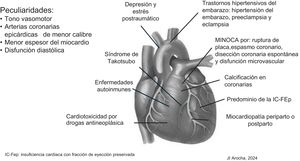 Peculiaridades y afecciones cardíacas en la mujer. Si bien la estructura y funcionamiento del corazón es idéntico en hombres y mujeres, existen diferencias distintivas, bien documentadas por las avanzadas técnicas de imagenología que implican expresiones clínicas diferentes. Fuente: Oliveira et al.8, Rodríguez Lozano et al.9 y Gurgoglione et al.10.