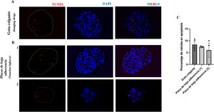 Presencia de células apoptóticas en los vasculoides crecidos en gota colgante o placa de baja adherencia. Imágenes representativas de análisis histológico de esferoides 3D de HUVEC-HUASMC crecidos en gota colgante A) o en placa de baja adherencia B) 1,2) teñidas con TUNEL. Barras de escala 50μm. C) Gráfica del porcentaje de células apoptóticas de cada grupo n=3-4 esferoides por condición.