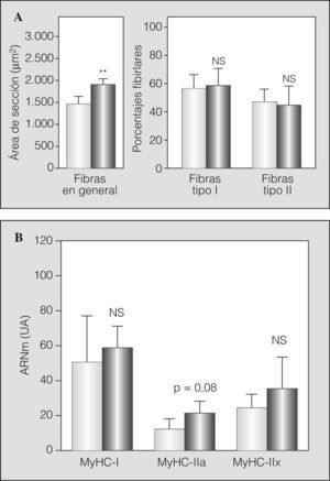 Fenotipo fibrilar en el músculo intercostal externo de controles sanos (barras claras) y pacientes con EPOC grave (barras oscuras): A) tamaño global de las fibras (área de sección transversal) y porcentajes de los tipos fibrilares I y II, y B) expresión en el ARN mensajero (ARNm) de las isoformas adultas humanas (I, IIa y IIx) de las cadenas pesadas de miosina (MyHC). NS: no significativo; UA: unidades arbitrarias. **p < 0,01.