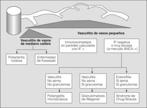 Clasificación de las vasculitis. ANCA: anticuerpos citoplásmicos antineutrófilos; IF: inmunofluorescencia. (Tomada de Jenette et al2.)