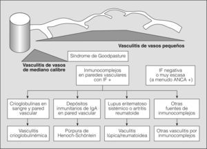 Clasificación de las vasculitis (continuación de fig. 1). ANCA: anticuerpos citoplásmicos antineutrófilos; IF: inmunofluorescencia; IgA: inmunoglobulina A. (Tomada de Jenette et al2.)