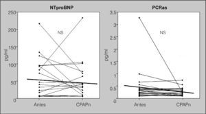Efecto de la presión positiva continua de la vía aérea nasal (CPAPn) sobre los valores de propéptido natriurético cerebral N-terminal (NTproBNP) y de proteína C reactiva de alta sensibilidad (PCRas), en pacientes con grave síndrome de apneas-hipopneas durante el sueño (n = 21) que fueron tratados durante 6 meses. No se apreciaron cambios significativos en los valores de NTproBNP y PCRas antes y después del tratamiento. NS: no significativo. Las líneas que cruzan las columnas de puntos representan los valores de la media.