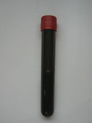 Líquido pleural de color negro obtenido en la toracocentesis.