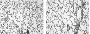 Cambios morfológicos. A) Caso representativo de un pulmón sano. B) Caso representativo de un pulmón instilado con cloruro de cadmio que muestra enfisema centroacinar con fibrosis peribronquial. Tinciones con hematoxilina-eosina. Las imágenes están tomadas con un aumento 100×CdCl2: cloruro de cadmio.