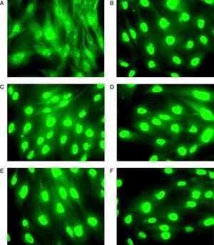 Imagen representativa que muestra la translocación del RG en fibroblastos de mucosa nasal obtenida mediante microscopía de fluorescencia. Previo a la incubación de los fibroblastos con GC (A) el RG se localiza tanto en el citoplasma como en el núcleo. Tras la incubación el GC (BUD) durante 30min (B), 1h (C), 2h (D), 3h (E) y 4h (F) la inmunofluorescencia correspondiente al RG es detectada en el núcleo de los fibroblastos.