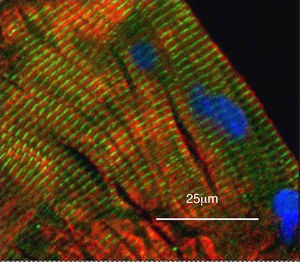 Imagen con microscopio de campo ancho de un corte longitudinal de músculo cuádriceps de un individuo control, sano, demostrándose la localización de YY1 en relación con los núcleos musculares mediante inmunohistoquímica. El músculo se tiñó para YY1 (verde), la cadena pesada de la miosina rápida (rojo) y los núcleos utilizando 4’,6-diamidino-2-fenilindol (azul). Se observa la tinción de YY1 a lo largo de los sarcómeros, no colocalizada con la miosina, y la ausencia de los núcleos.