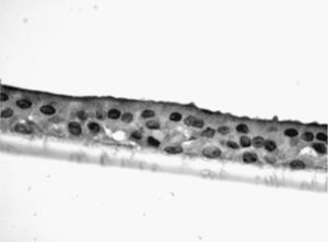 Fotomicrografía de epitelio seudoestratificado diferenciado obtenido de células epiteliales bronquiales humanas diferenciadas obtenidas en individuos fumadores sanos.