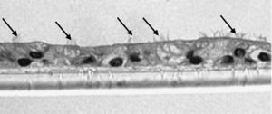 Fotomicrografía de epitelio seudoestratificado diferenciado obtenido de células epiteliales bronquiales humanas diferenciadas obtenidas en individuos fumadores sanos en la que se observan las estructuras ciliares (señaladas con flechas) y células secretoras (halo blanco).