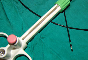 Pinzas de biopsia broncoscópica (fig. 2) con electrocauterización (biopsia caliente).