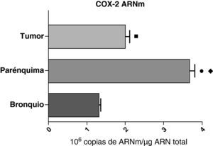 Expresión de la ARNm de la COX-2 en el tumor, el parénquima pulmonar y los bronquios de los pacientes EPOC con carcinoma escamoso (n=27). Se representan las medias con los errores típicos de la media. La expresión del ARNm se muestra en forma de número de moléculas con respecto al ARN total. ¿ p<0,001 entre parénquima y tumor.  p<0,0001 entre parénquima y bronquio. ¿ p<0,01 entre tumor y bronquio.