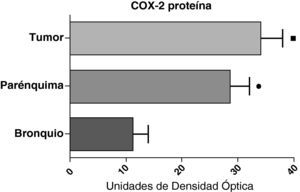 Expresión de la proteína de la COX-2 en el tumor, el parénquima pulmonar y los bronquios de los pacientes EPOC con carcinoma escamoso (n=27). Se representan las medias con los errores típicos de la media. La proteína se expresa en forma de unidades de densidad óptica. ¿ p<0,01 entre tumor y bronquio. ¿ p<0,01 entre parénquima y bronquio. No hubo diferencias estadísticamente significativas entre tumor y parénquima.