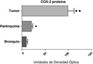 Expresión de la proteína de la COX-2 en el tumor, el parénquima pulmonar y los bronquios de los pacientes EPOC con adenocarcinoma (n=17). Se representan las medias con los errores típicos de la media. La proteína se expresa en forma de unidades de densidad óptica. ¿ p<0,001 entre tumor y bronquio.  p<0,01 entre tumor y parénquima. ¿ p<0,05 entre parénquima y bronquio.
