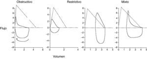 Morfología de la curva flujo-volumen en los distintos patrones funcionales respiratorios.