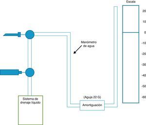 Esquema de un sistema de manometría pleural. El catéter que se introduce en el espacio pleural se conecta a una llave de 3 vías que permitirá medir la presión pleural o drenar el derrame, según en qué sentido se abra la llave de paso. En el manómetro de agua se instalará un sistema de amortiguación (aguja de 22G) para impedir grandes oscilaciones de la columna de agua con los movimientos respiratorios teniendo la precaución de que el punto cero de la escala de agua esté al mismo nivel que el catéter.