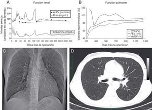 Datos de seguimiento de la función renal y pulmonar tras el doble trasplante.
