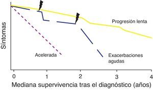 Historia natural de la fibrosis pulmonar idiopática.